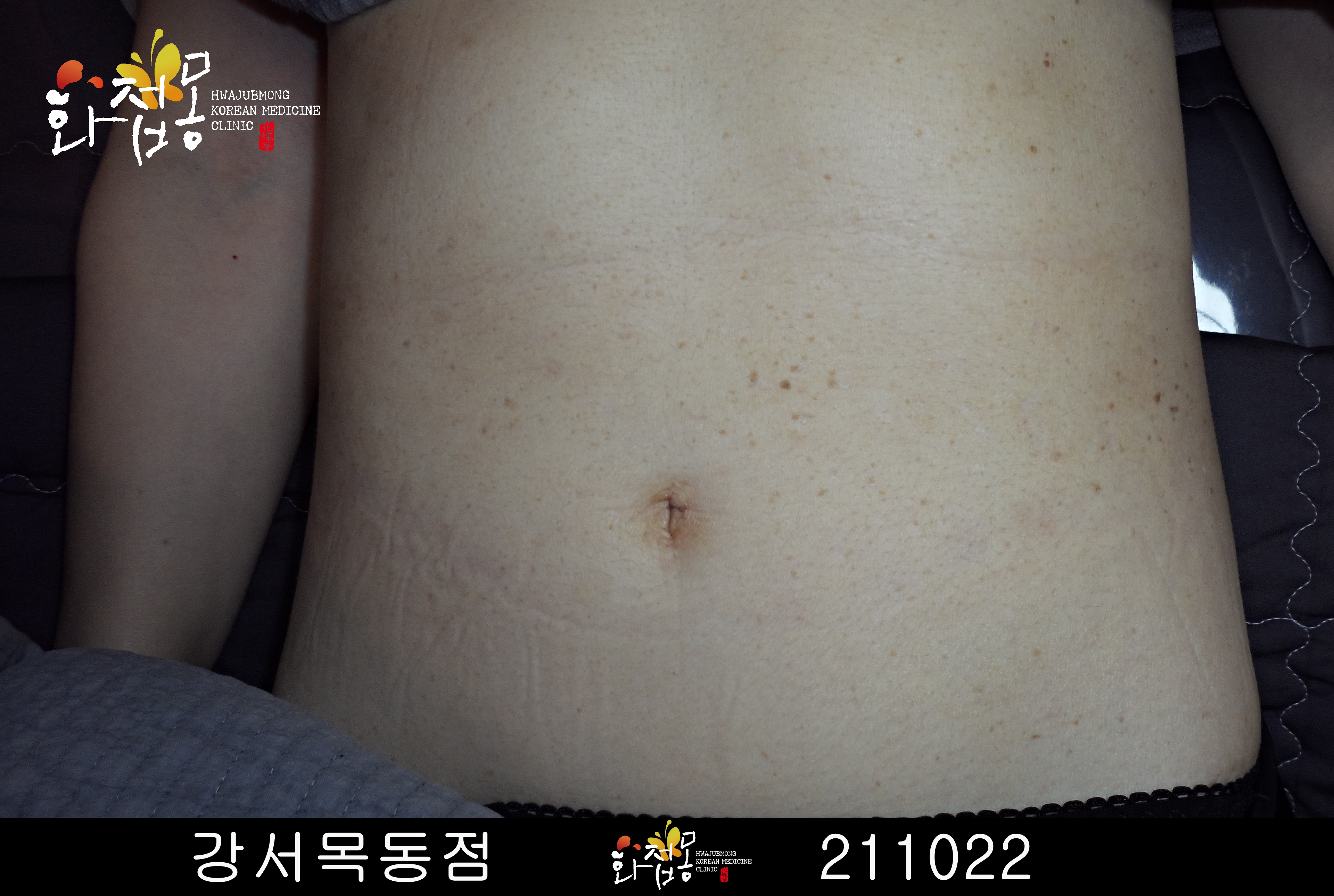 전후사진