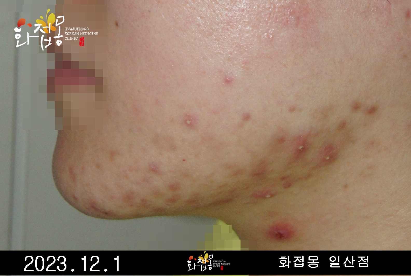 전후사진