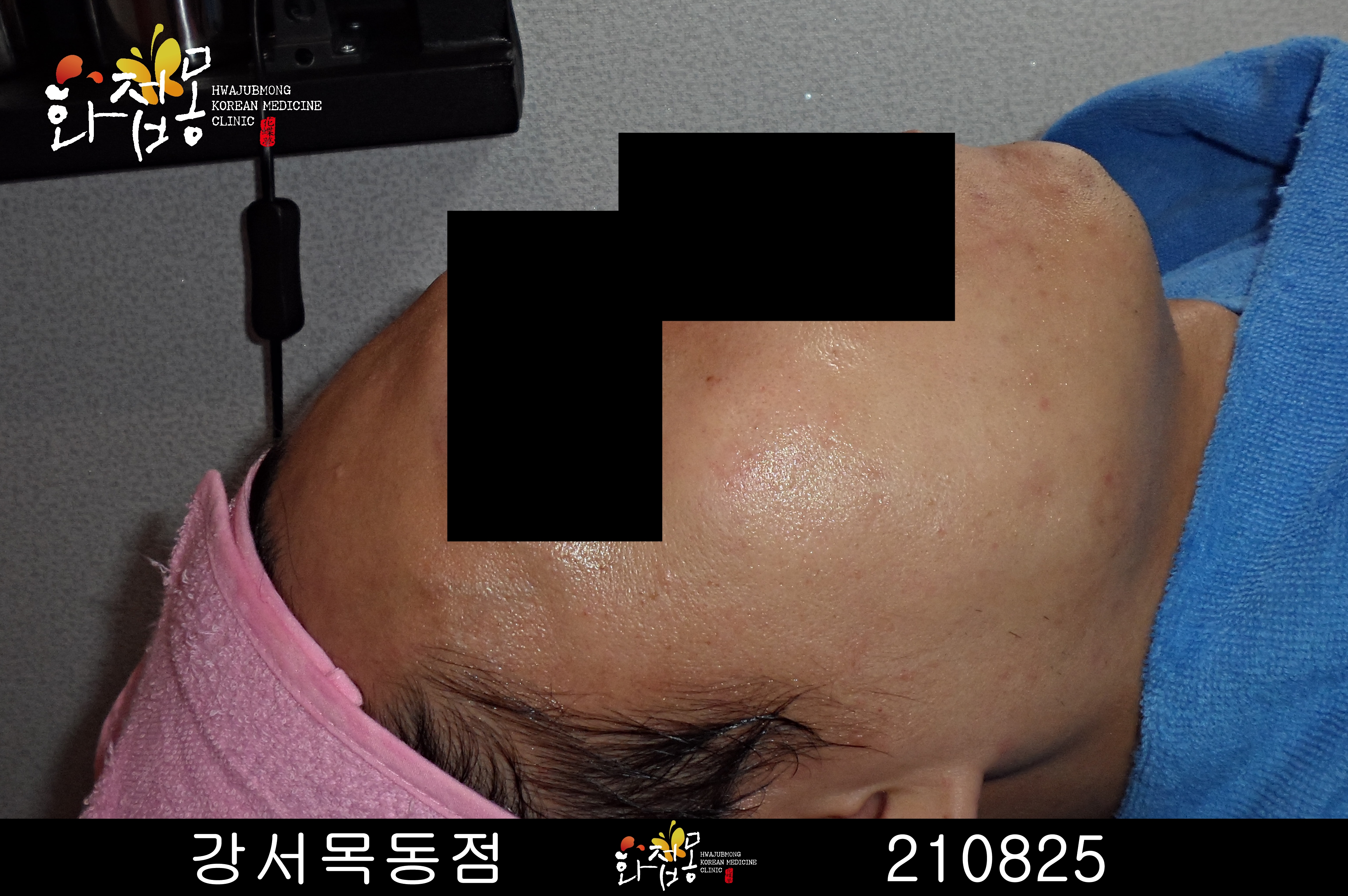 전후사진