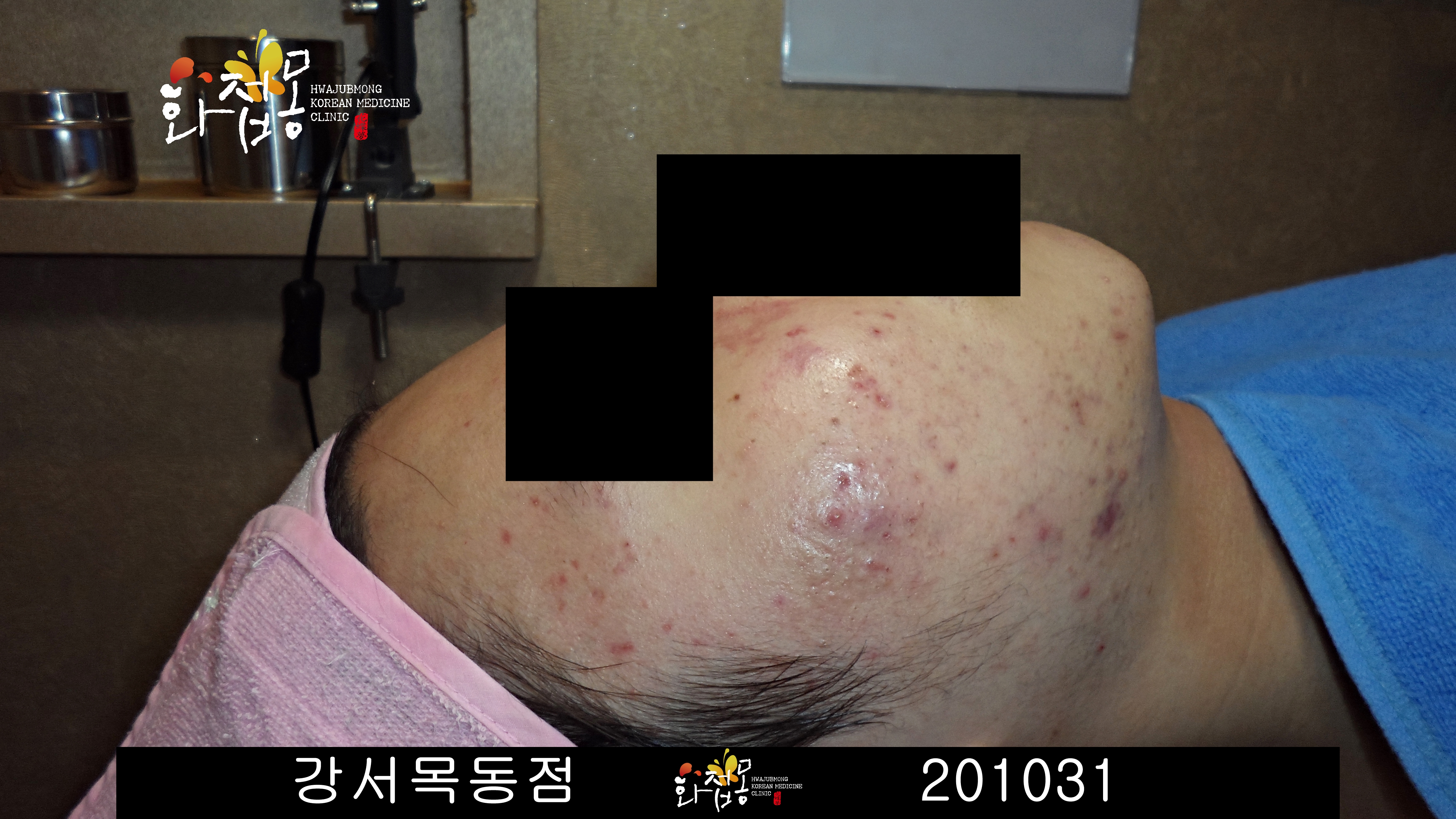 전후사진