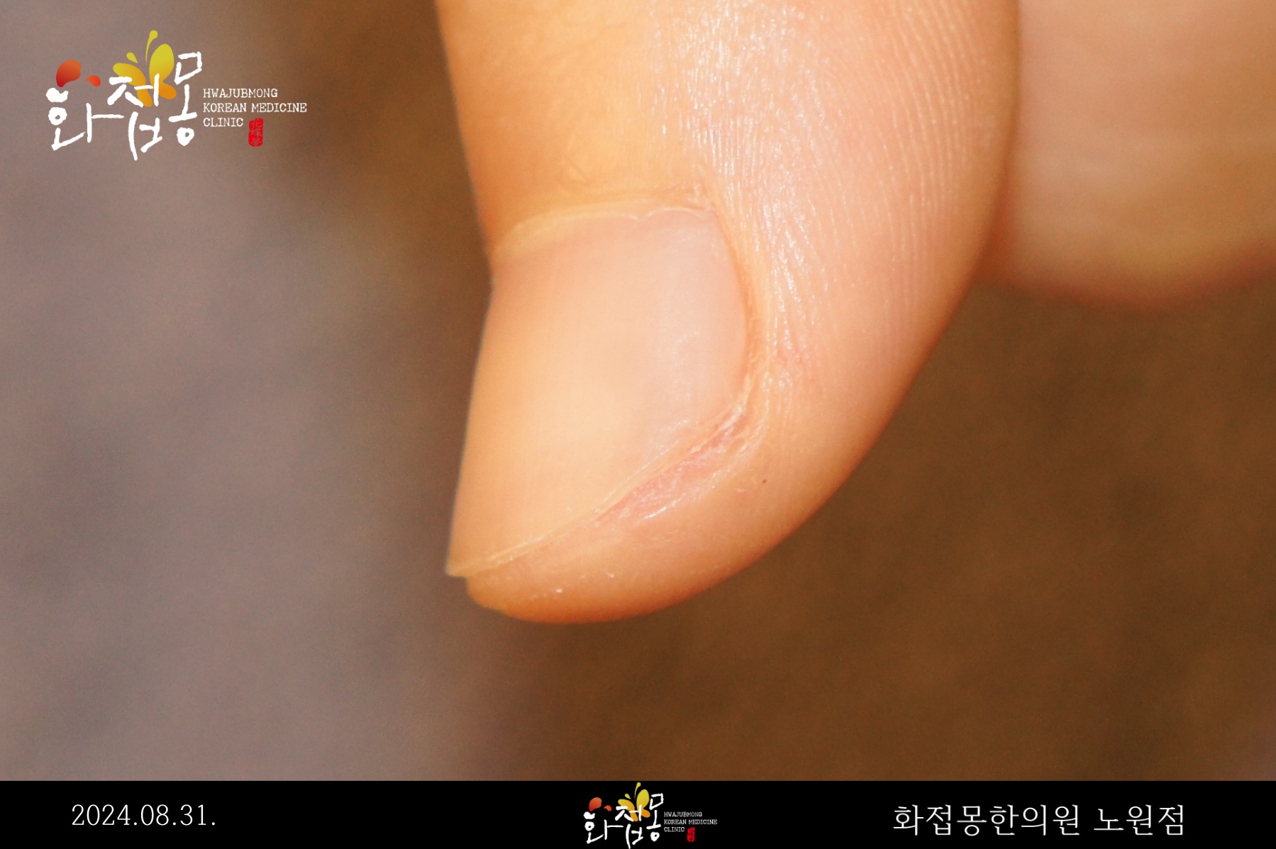 전후사진