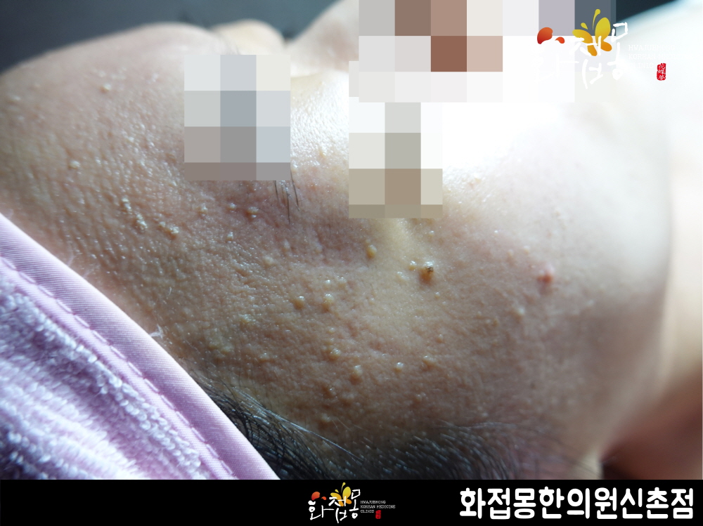 전후사진