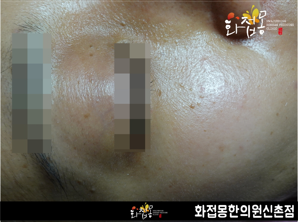 전후사진