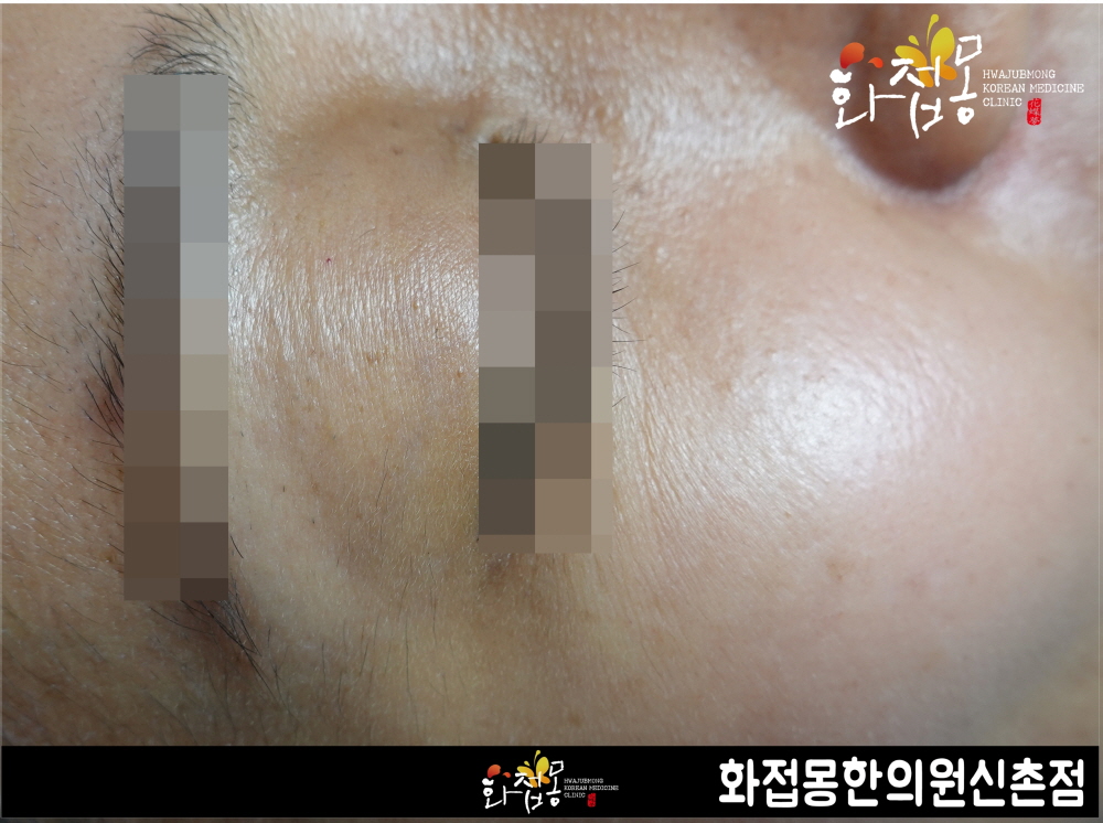 전후사진