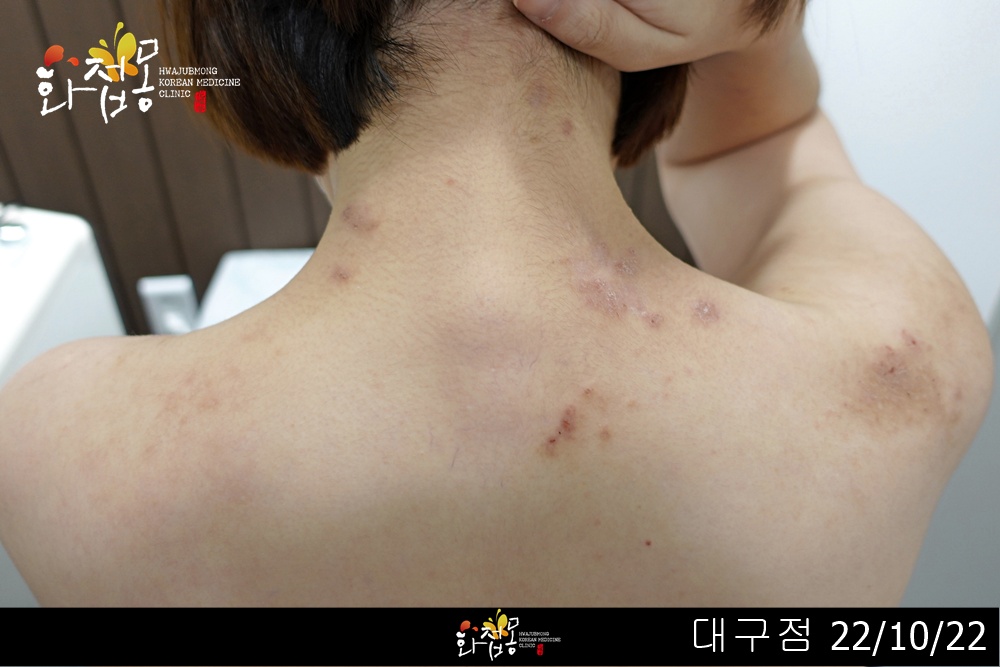 전후사진