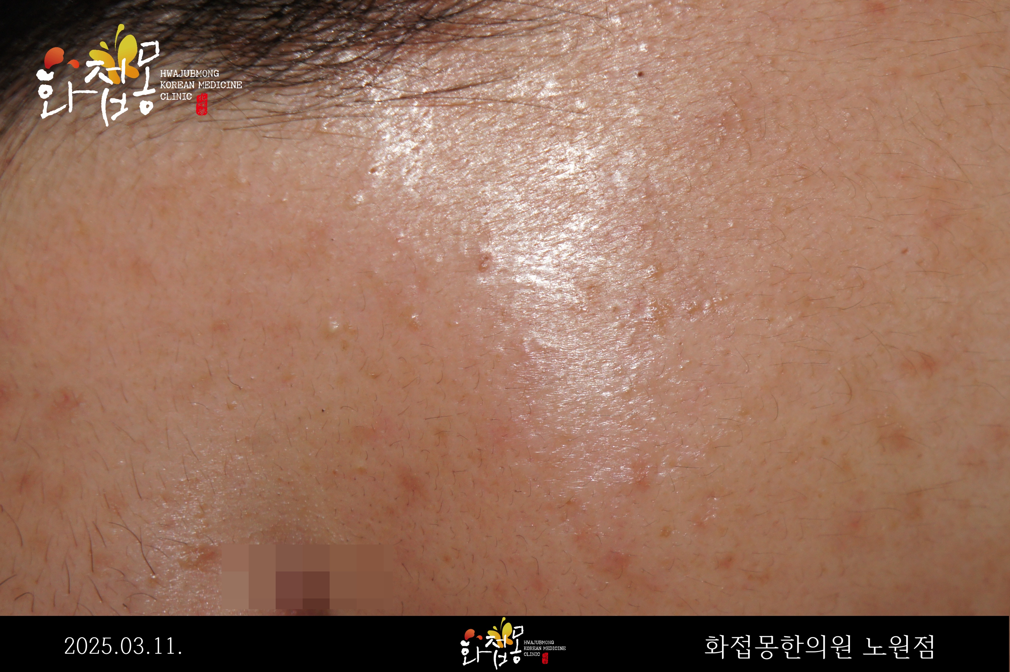 전후사진