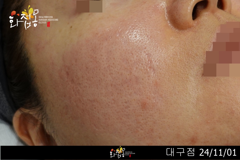 전후사진