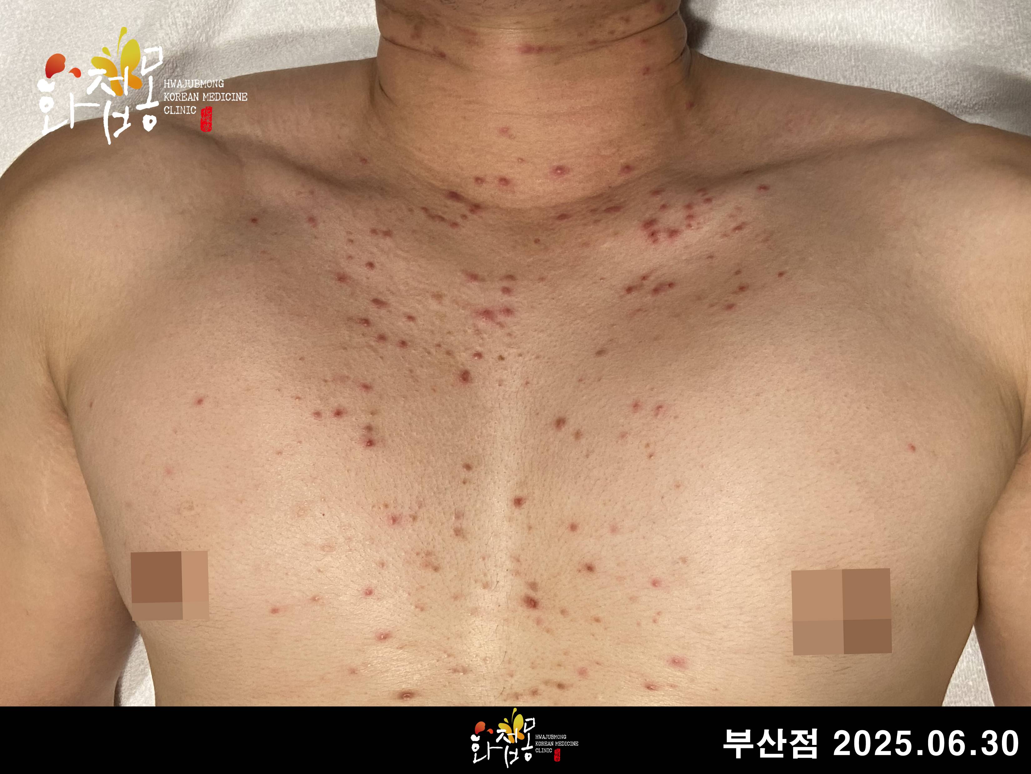 전후사진